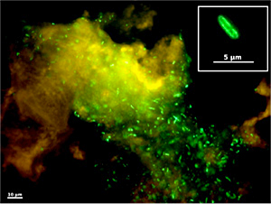 Mikroskopische Aufnahme von Bakterien auf einer Mundschleimhaut-Epithelzelle 
