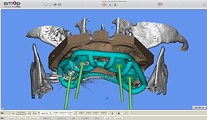 3D-Abbildung der Gebisssituation 